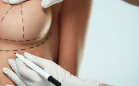 Best Breast Enlargement Surgeon in Dubai: The Benefits of Choosing a Skilled Expert for Your Surgery