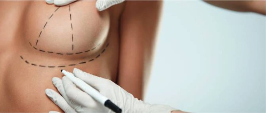 Best Breast Enlargement Surgeon in Dubai: The Benefits of Choosing a Skilled Expert for Your Surgery