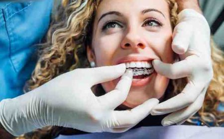 Understanding Your Options for Smile Improvement in Fulham