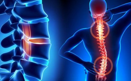 History of Lower Back Pain Relief (Lumbar Pain)
