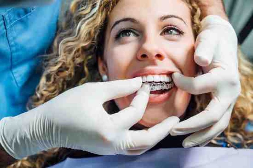 Understanding Your Options for Smile Improvement in Fulham