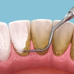 butternutfamilydentistry